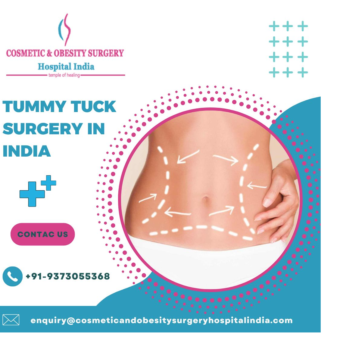 Tummy Tuck Surgery Cost India